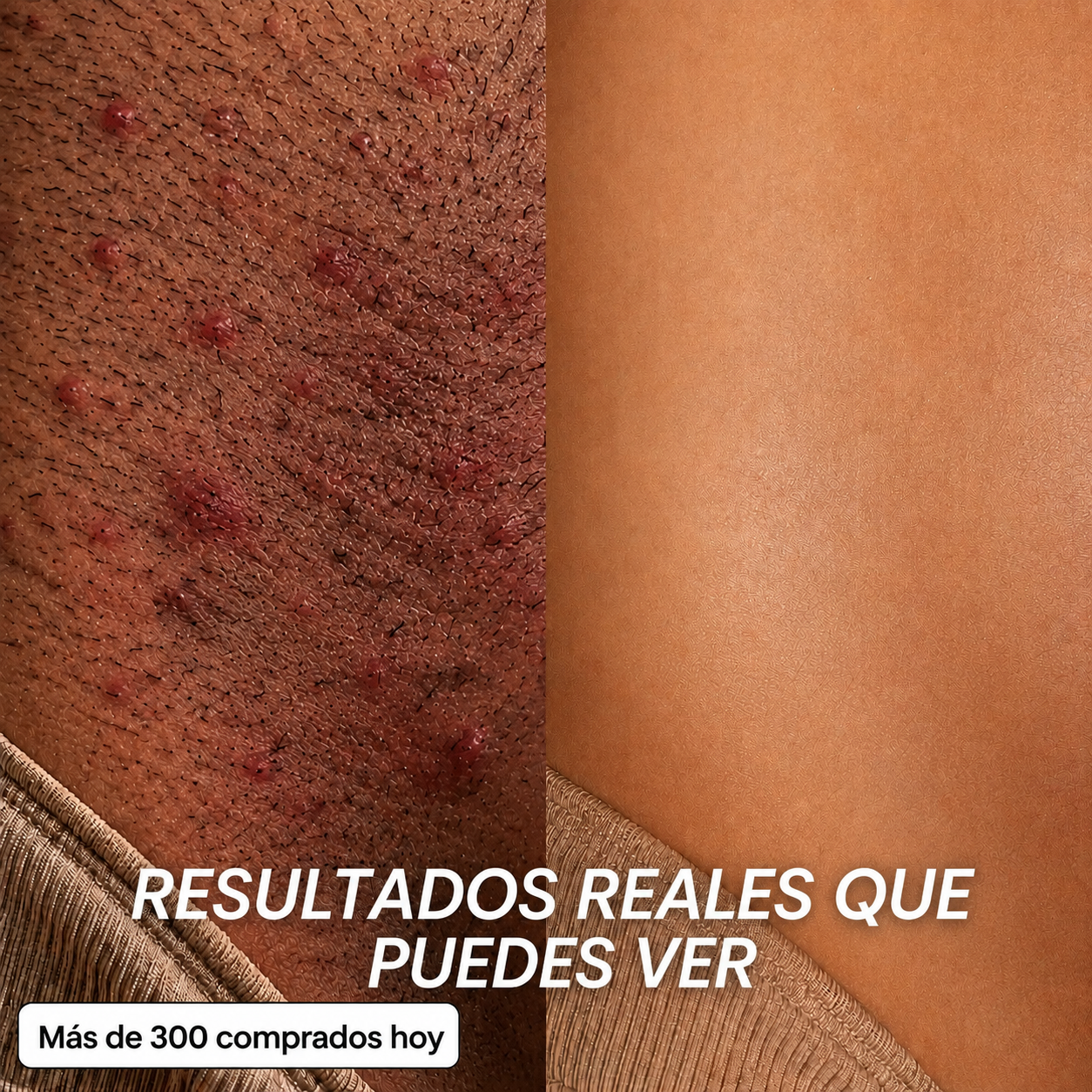 VELORIA PRO - Aceite Anti Crecimiento de Vello