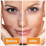 CurcoPro™ - JABÓN DE CÚRCUMA 100% ORGANICO/NATURAL