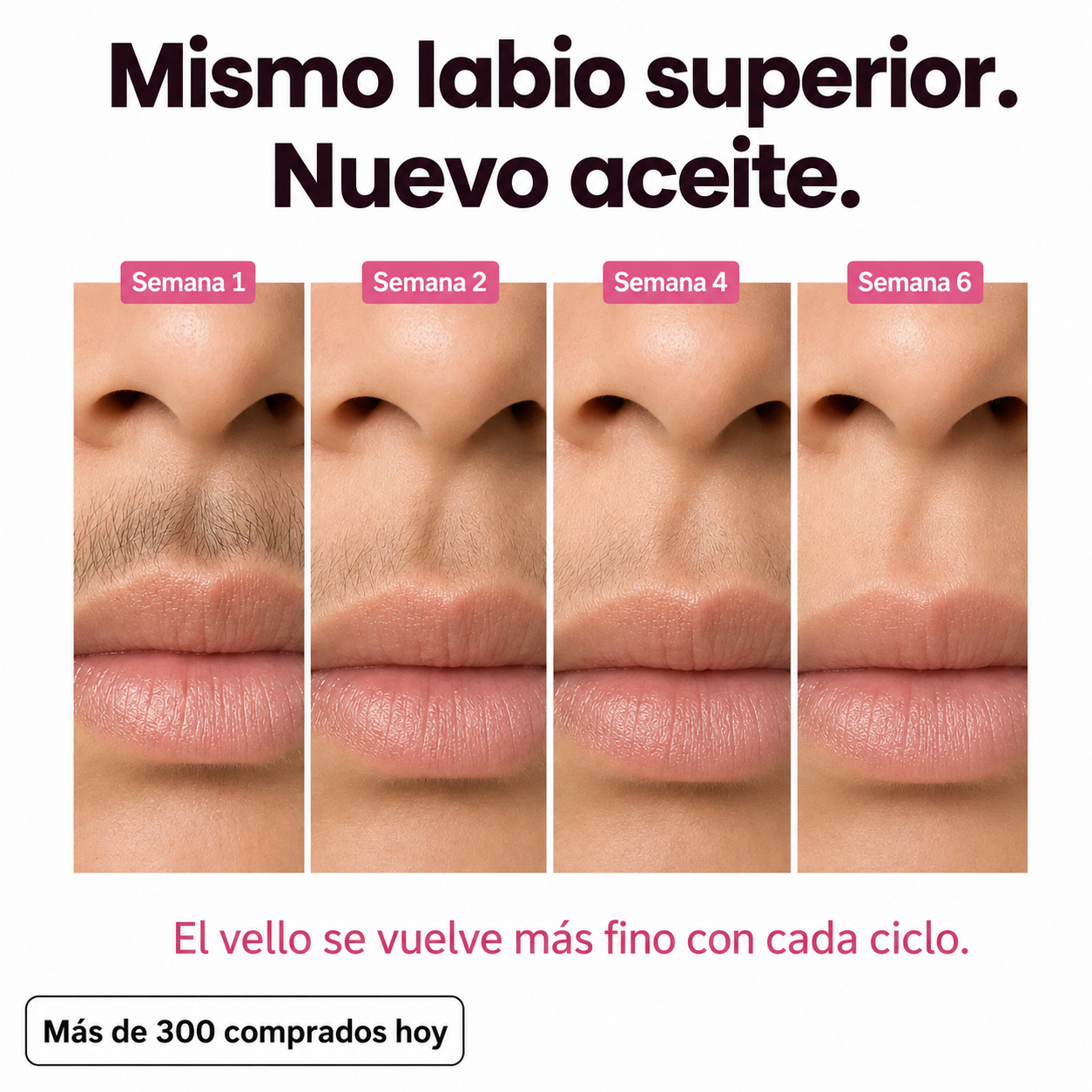 VELORIA PRO - Aceite Anti Crecimiento de Vello